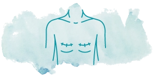 Breast scar icons